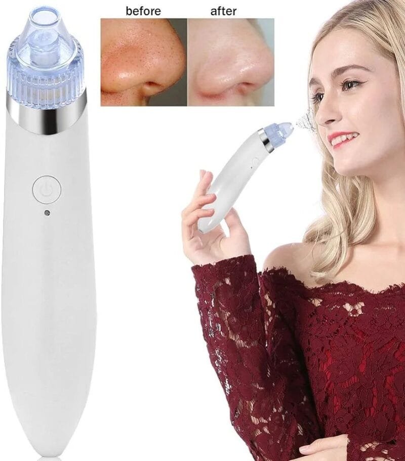 (NW000202) KEMEI BLACKHEAD SUCKER MACHINE 8050 / Kemei KM-8050 Beauty Skin care specialist - Image 2